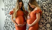 "Совместная беременность" легендарных израильских близнецов | Фото 7
