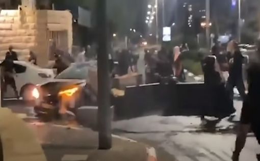 Жертву линча в Акко перевели в реабилитационный центр