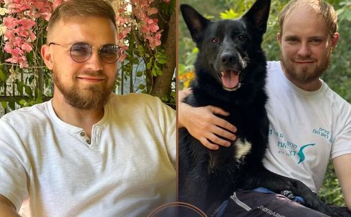 Революция в Израиле: технология пересадки волос с пожизненной гарантией